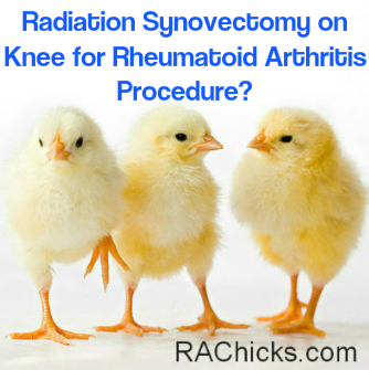 Member Discussions and Questions Radiation Synovectomy on Knee for Rheumatoid Arthritis Procedure Member Discussion from RA Chicks :Women with Rheumatoid Arthritis